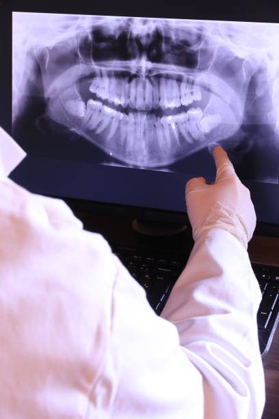 Best Emergency Gum Treatment in Landrum, SC
